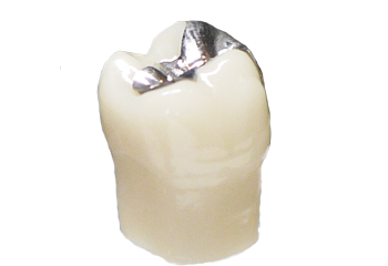 crown_allcera